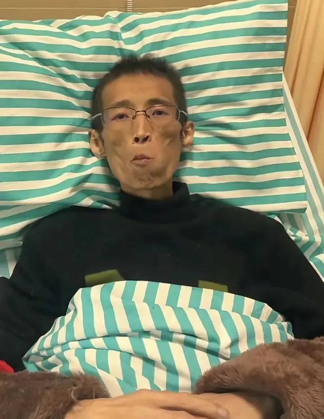 43岁抗癌网红“东东”去世，胃癌暴瘦只剩65斤，曾是一名帅气医生